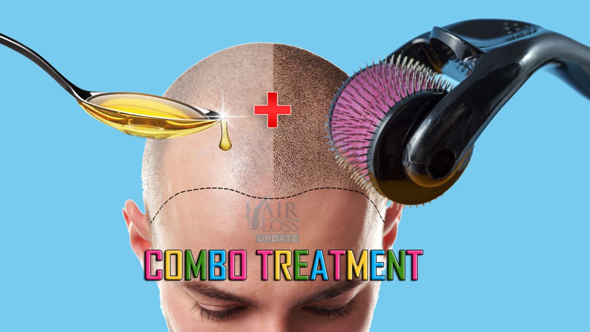 Does Derma Roller Work For Hair Regrowth