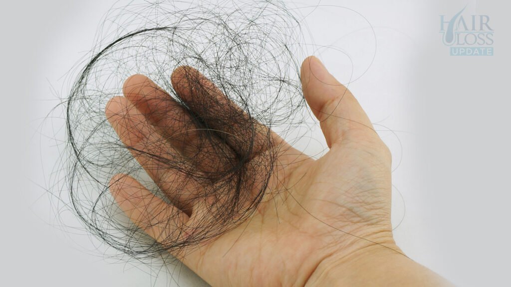 Normal Daily Hair Loss