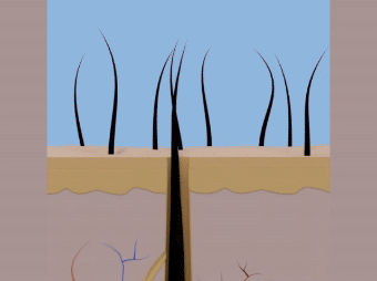 Catagen phase animated video hair cycle animated