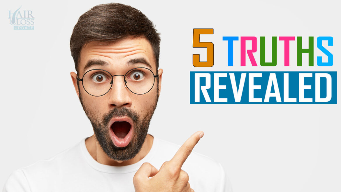 Common Dandruff Myths Debunked