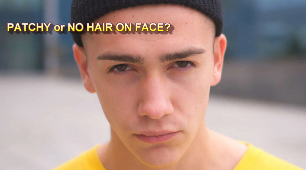 patchy beard or no facial hair at all